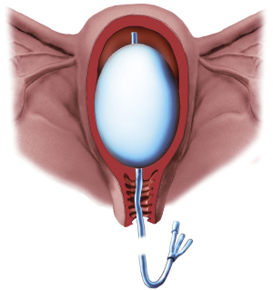 1b971a9fddb79903.PK_1_1