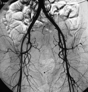 1be2cf1ebf5721ef.obr_1_1