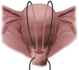 55f28d9715bbdff6.PK_2a_1