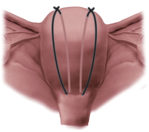 f559648e926da6e6.PK_3a_1